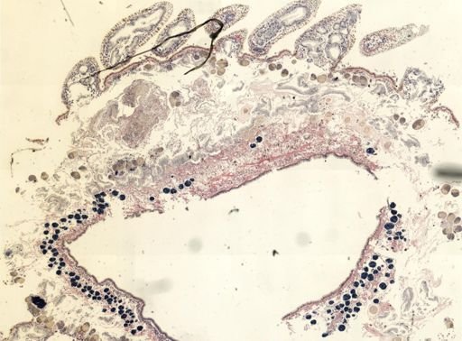Thysanozoon brocchii