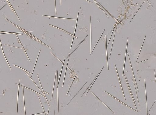 Cladorhiza virgata