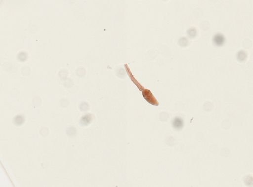 Schistosoma mansoni