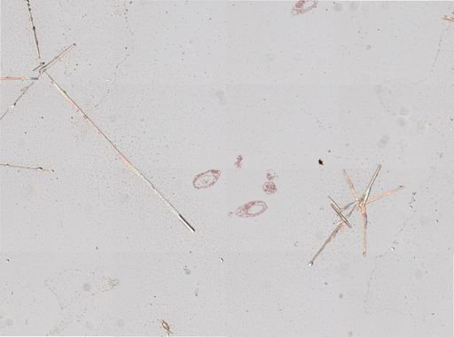 Fasciola hepatica