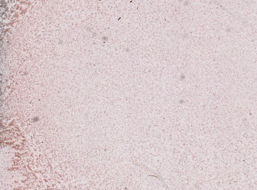 Babesia bigemina