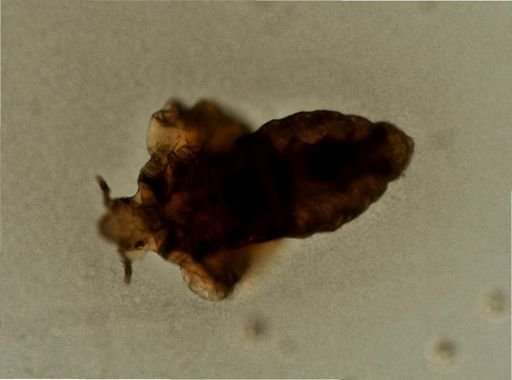 Pediculus humanus