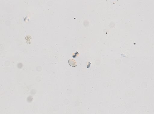 Trichuris vulpis
