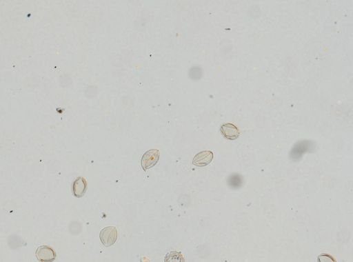 Diphyllobothrium latum