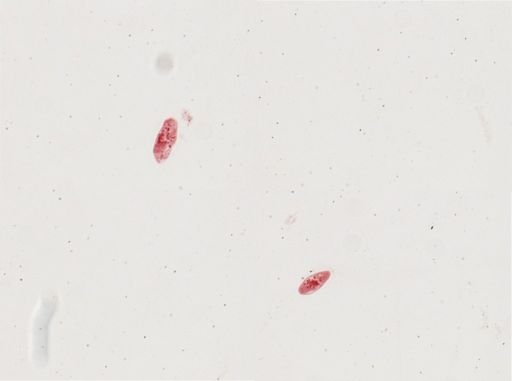 Paramecium calkinsi