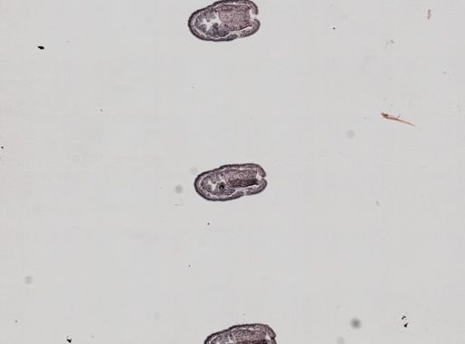 Plagiostomum whitmani
