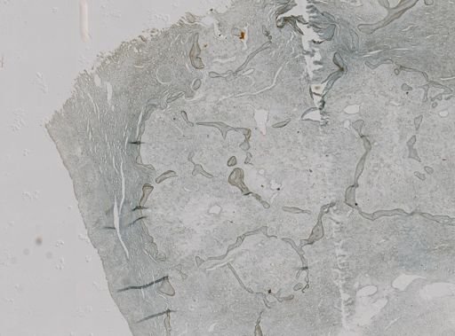 Pseudoceratina purpurea