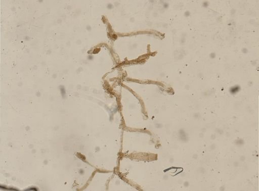 Aetea ligulata