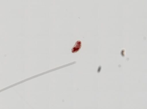 Trematoda