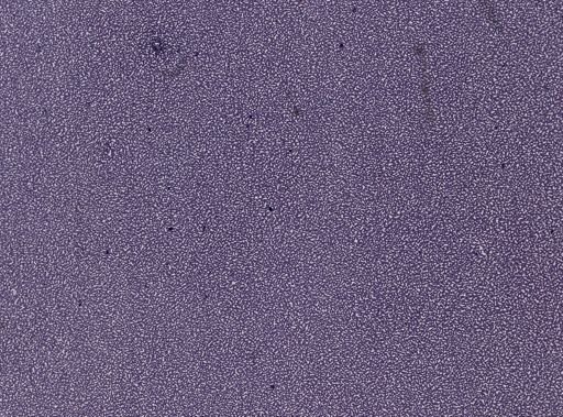 Plasmodium vivax