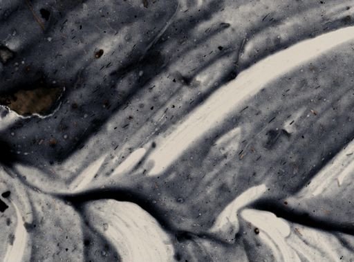 Entamoeba histolytica