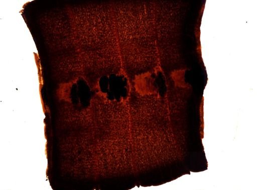 Diphyllobothrium erinacei