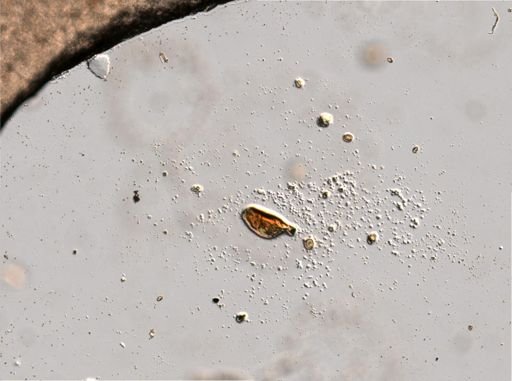 Trichocerca tenuior