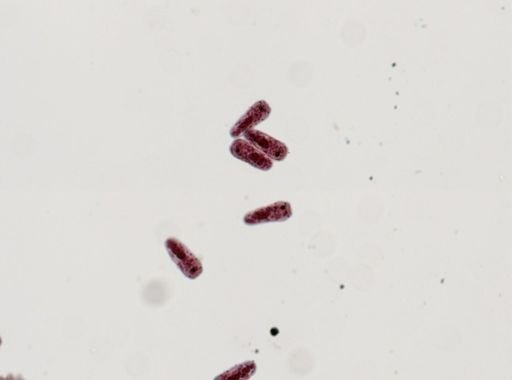 Fasciola hepatica