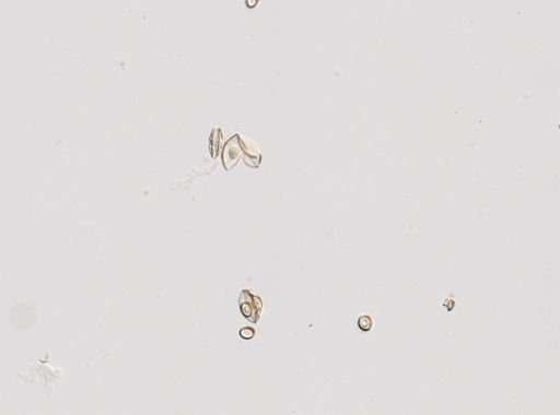 Cestoda