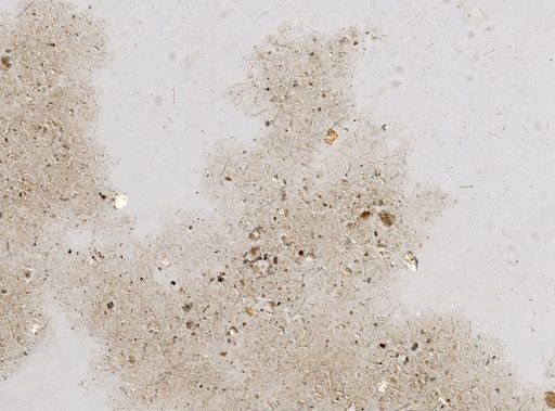 Stromatospongia micronesica