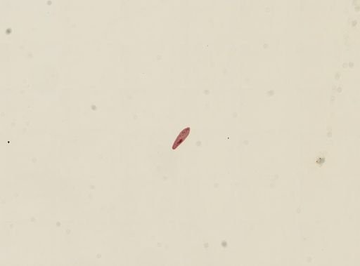 Paramecium caudatum