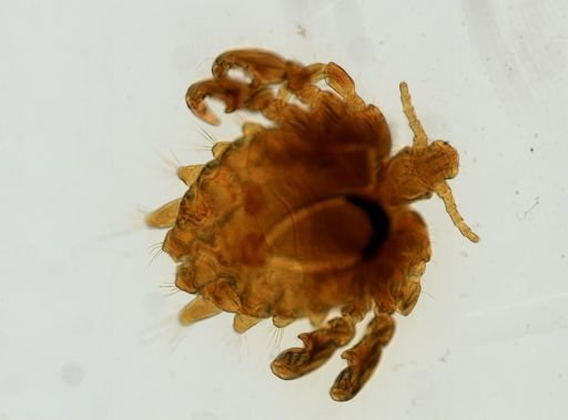 Pthirus pubis