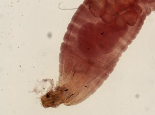 Echinorhynchus proteus
