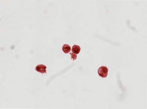 Cerebratulus