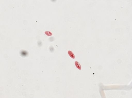 Paramecium calkinsi