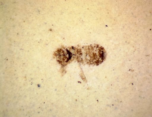 Hemiptera?