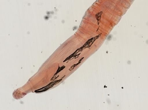 Oligacanthorhynchus microcephalus