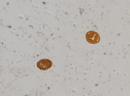 Tubulanus pellucidus