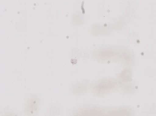 Hyalella cf. azteca