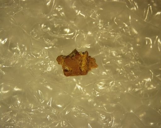 Adapisoricidae sp.