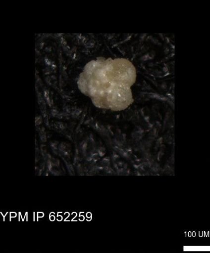 undet. Rugoglobigerinidae