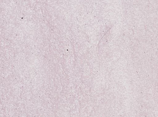Plasmodium vivax