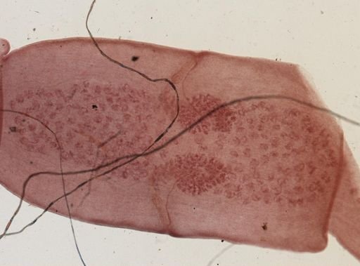 Dipylidium caninum