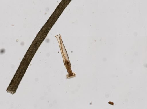 Rotifera