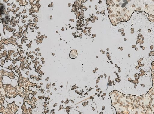 Testudinella incisa?