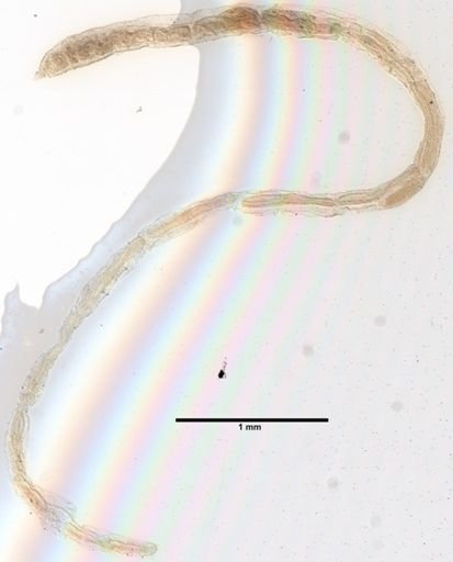 Limnodriloides medioporus
