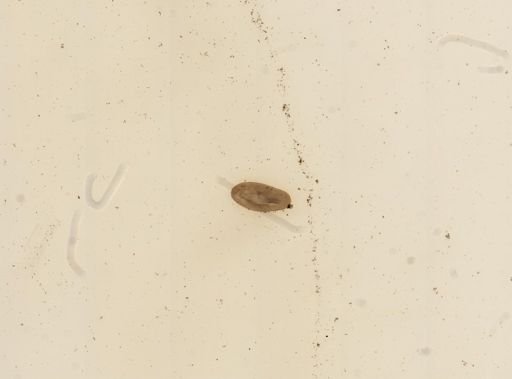 Stentor coeruleus