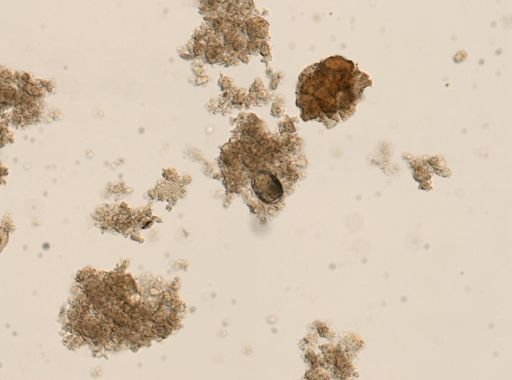 Kiricephalus coarctatus