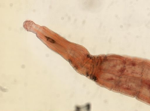 Oligacanthorhynchus microcephalus