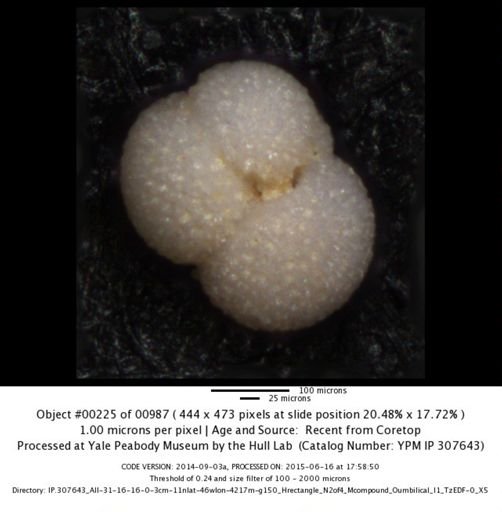 Globigerinoides sacculifer