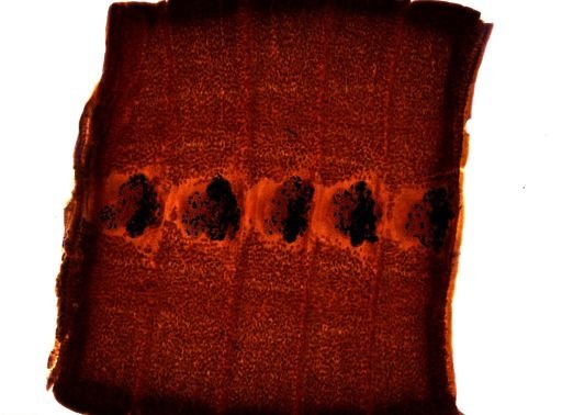 Diphyllobothrium erinacei