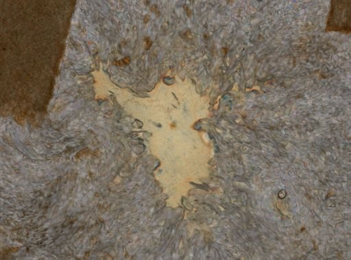 Notholca striata