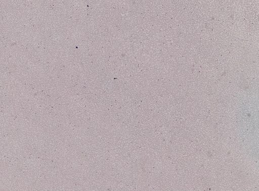 Plasmodium falciparum