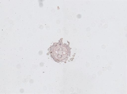 Plicatoperipatus jamaicensis