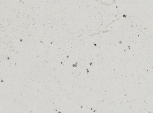 Amoeba proteus