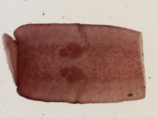 Dipylidium caninum