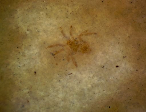 undet. Araneae