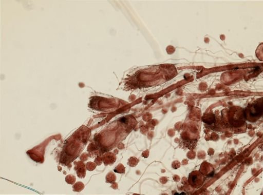 Gonothyraea