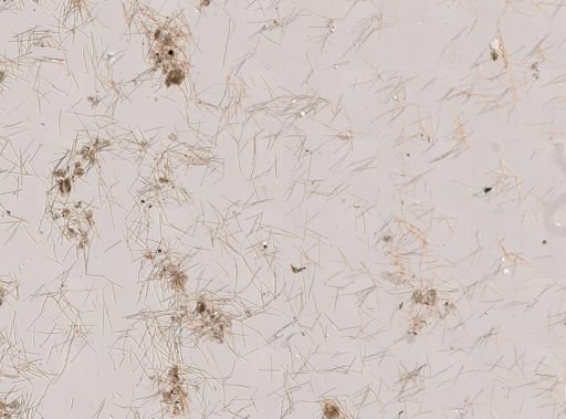 Hymedesmia?