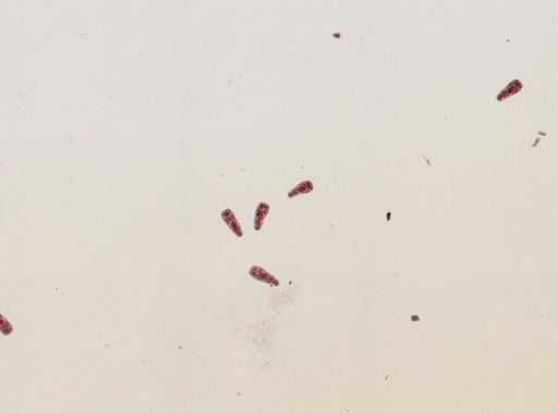 Fasciola hepatica